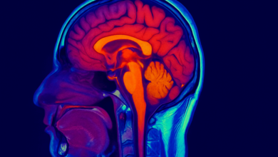 Brain scan representing neurological patterns in New Brunswick illness